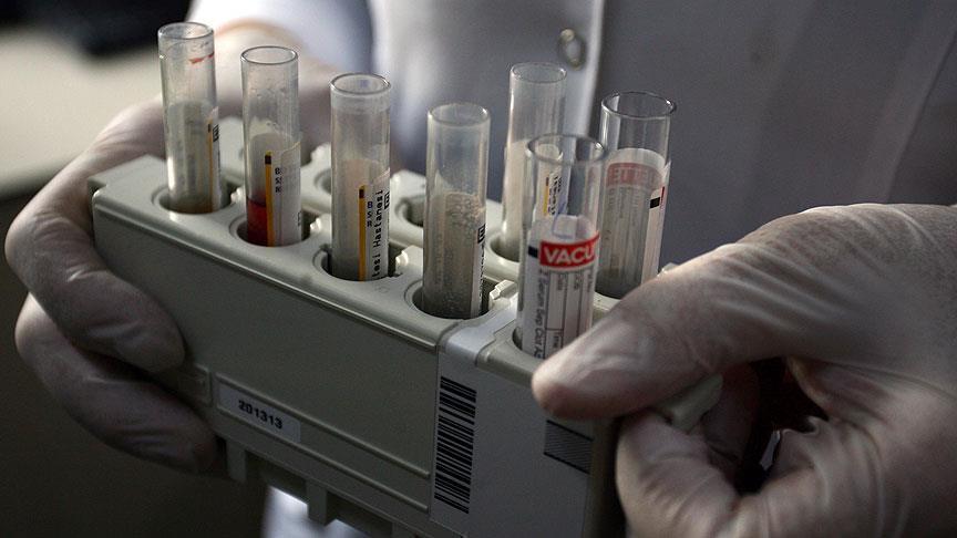 اختبار للدم يتنبأ بالزهايمر قبل ظهوره بـ8 سنوات